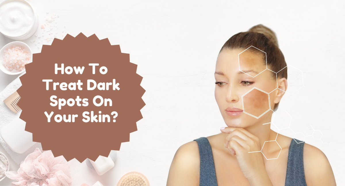 How To Treat Dark Spots On Your Skin?